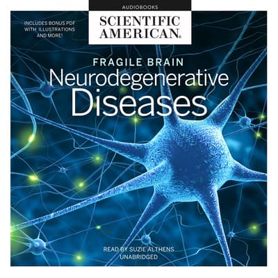 Fragile Brain by Scientific American audiobook